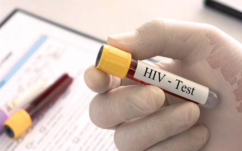 Nie&nbsp;wiedzą, że&nbsp;mają HIV