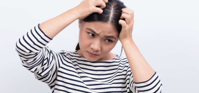 Co powoduje łupież?