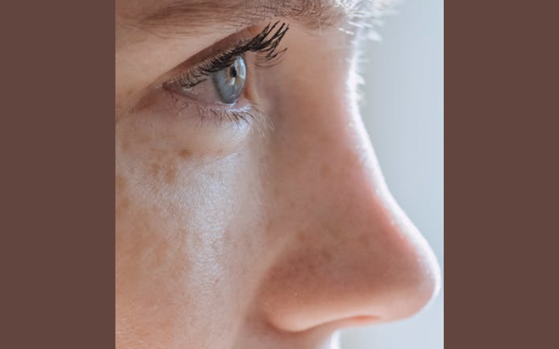 Wągry na nosie – jak skutecznie się ich pozbyć?