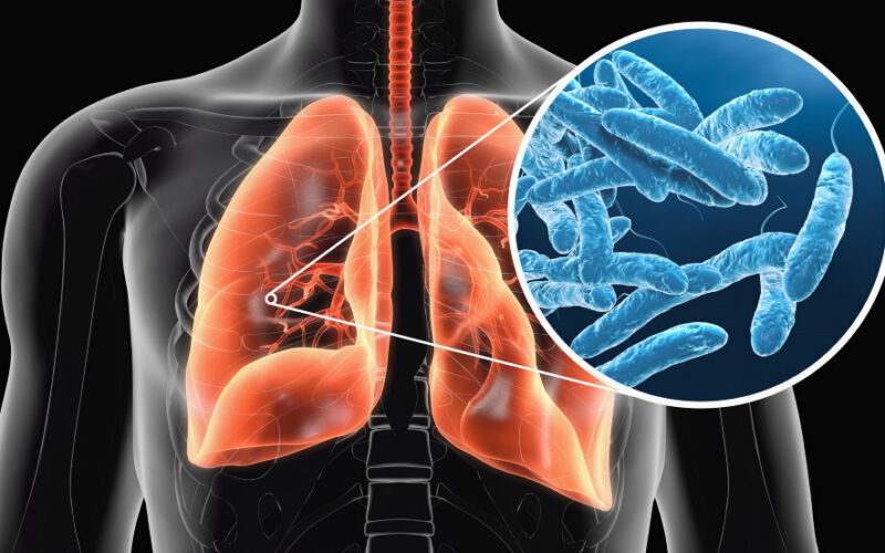 Legionella i inne bakterie