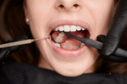 Periodontologia i higiena jamy ustnej