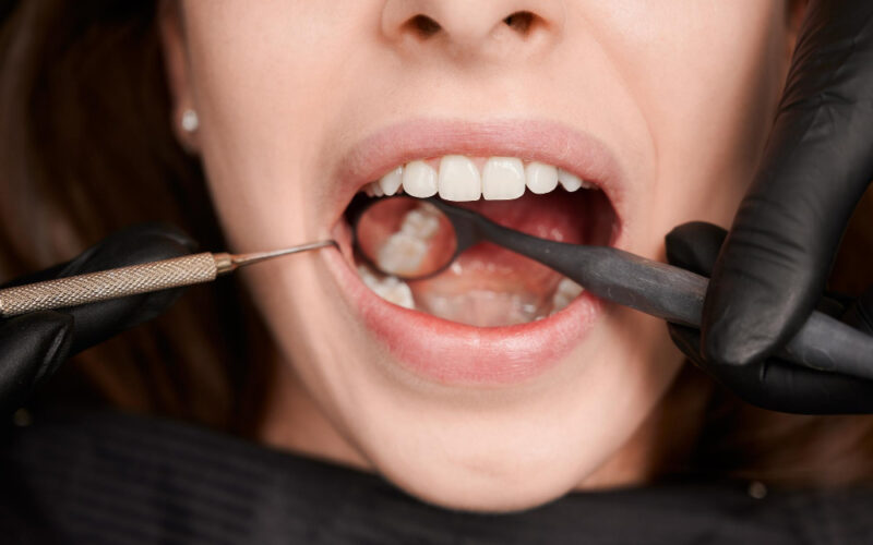 Periodontologia i higiena jamy ustnej