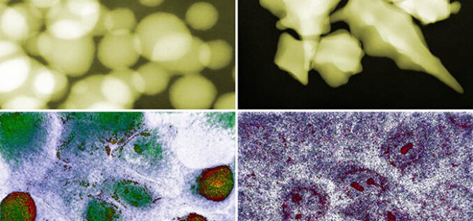 Złoto na nowotwory