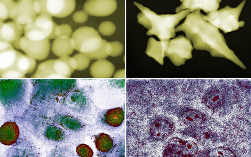 Złoto na nowotwory