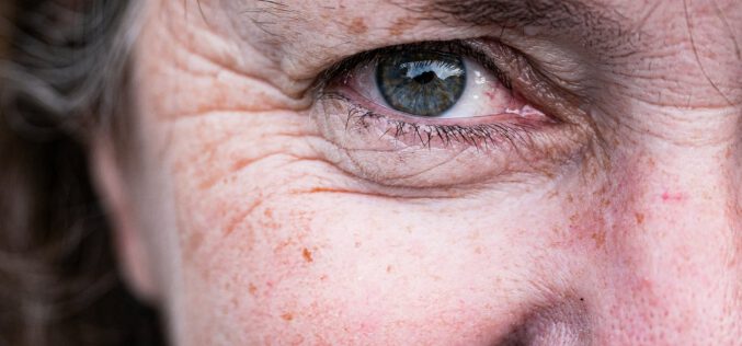 Czy kolagen do picia działa? – wywiad z ekspertem Ysto