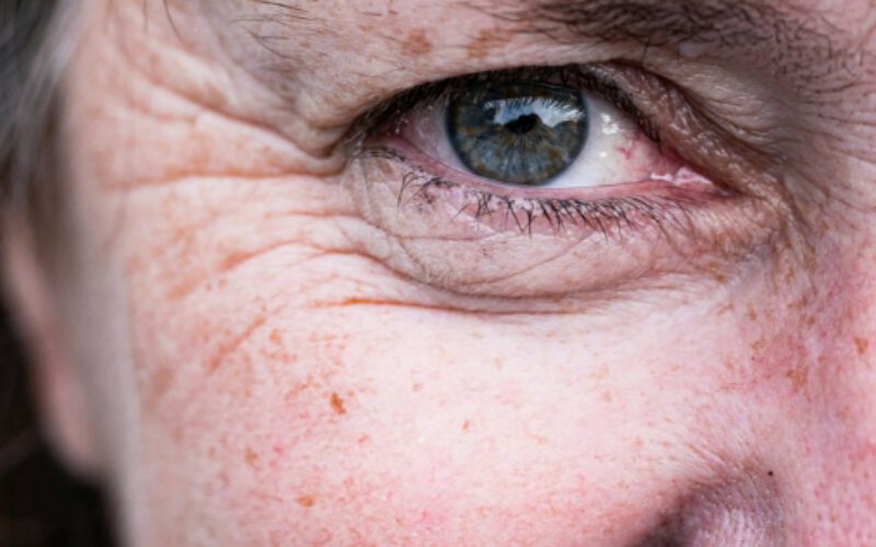 Czy kolagen do picia działa? – wywiad z ekspertem Ysto