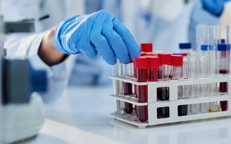 Prawie normalne życie