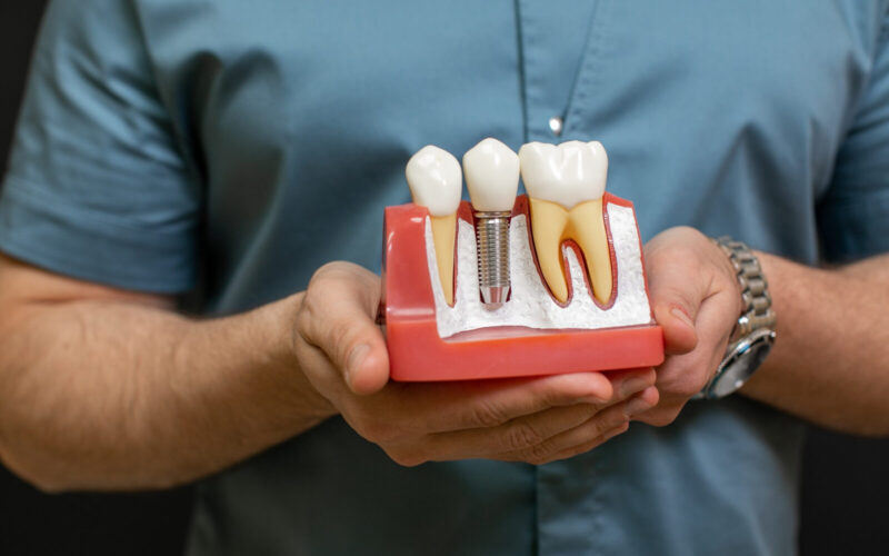 Szczoteczka soniczna dla osób z implantami – czy to bezpieczne?